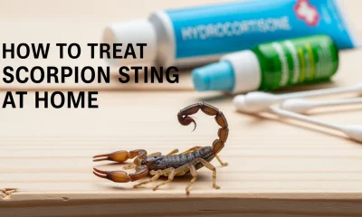 How to Treat a Scorpion Sting at Home